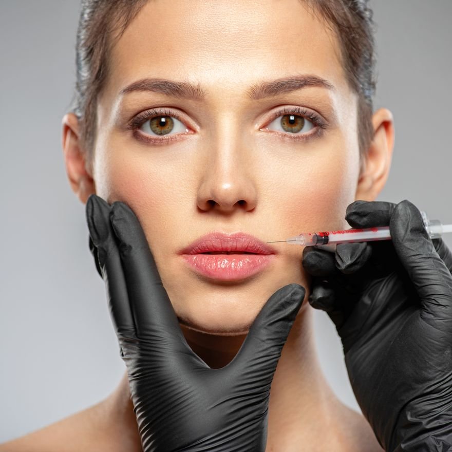Dermal filler treatment