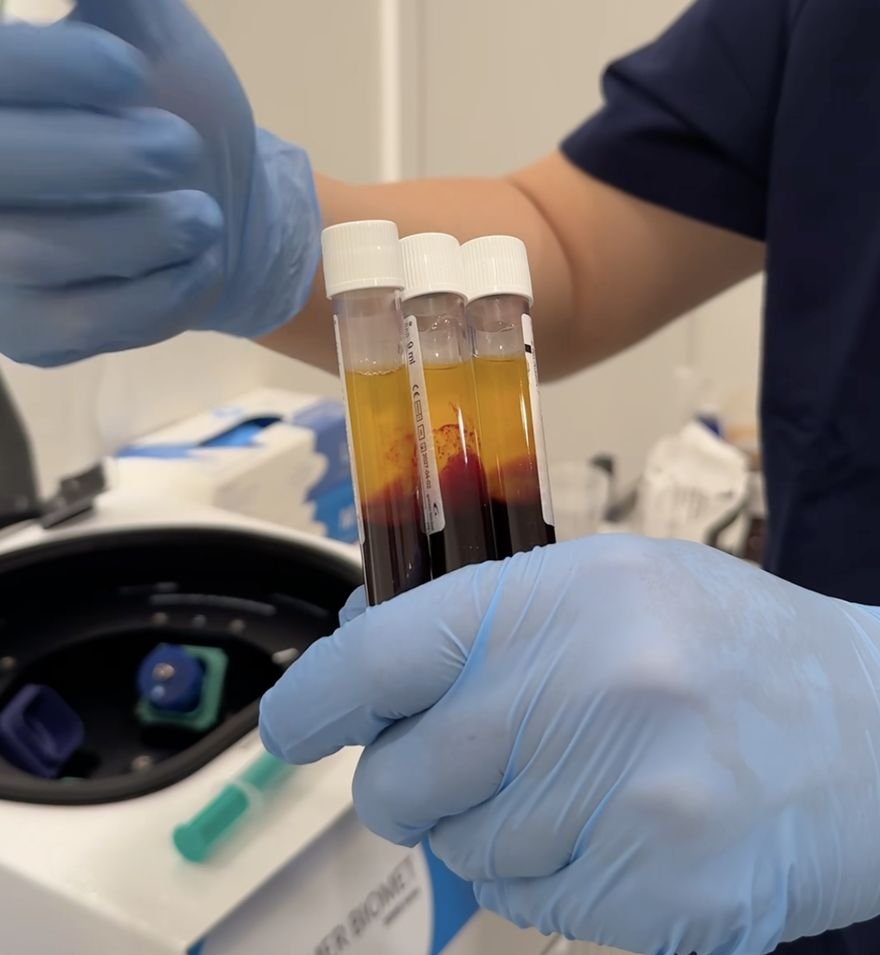 GPS III PRP preparation